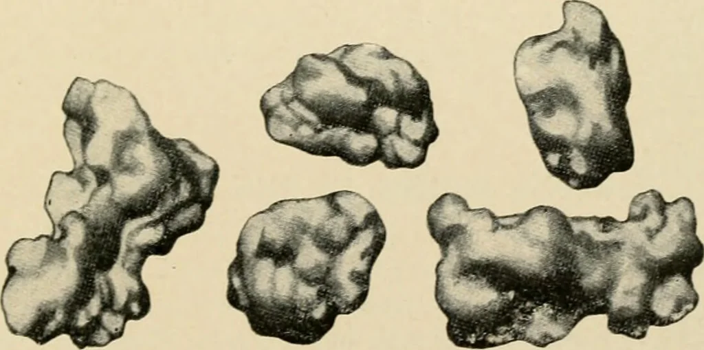 An illustration from The principles and practice of modern surgery / by Roswell Park ... with 722 engravings and 60 full-page plates in colors and monochrome., 1907, leaf 471