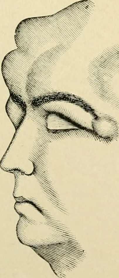An illustration from The principles and practice of modern surgery / by Roswell Park ... with 722 engravings and 60 full-page plates in colors and monochrome., 1907, leaf 500