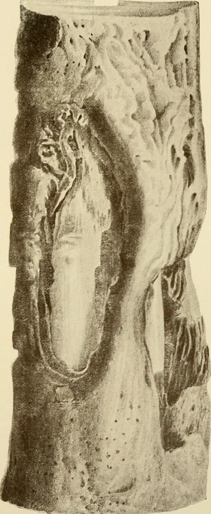 An illustration from The principles and practice of modern surgery / by Roswell Park ... with 722 engravings and 60 full-page plates in colors and monochrome., 1907, leaf 503