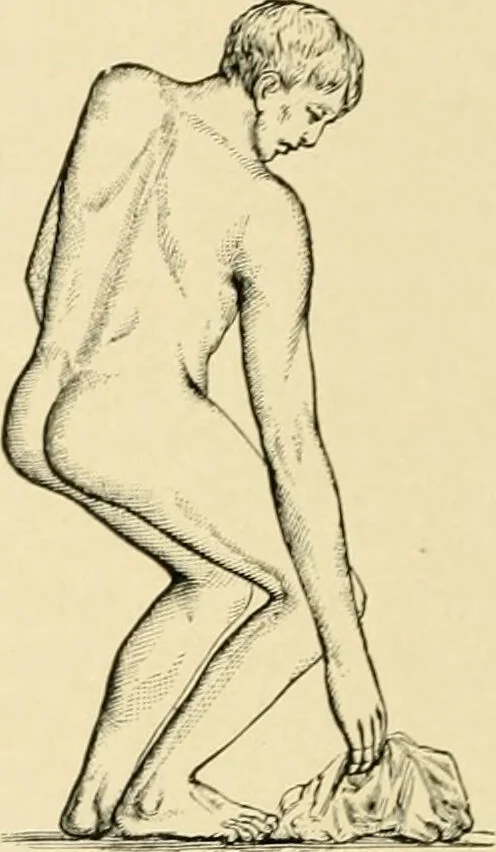 An illustration from The principles and practice of modern surgery / by Roswell Park ... with 722 engravings and 60 full-page plates in colors and monochrome., 1907, leaf 522