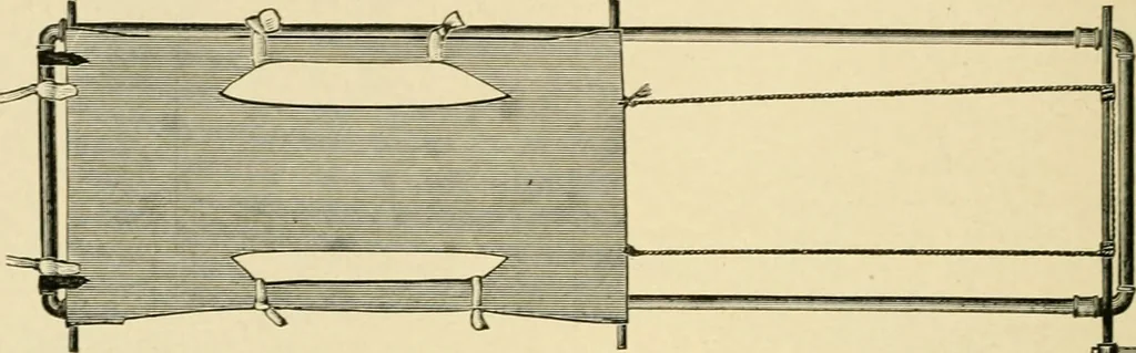 An illustration from The principles and practice of modern surgery / by Roswell Park ... with 722 engravings and 60 full-page plates in colors and monochrome., 1907, leaf 526