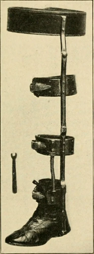 An illustration from The principles and practice of modern surgery / by Roswell Park ... with 722 engravings and 60 full-page plates in colors and monochrome., 1907, leaf 547