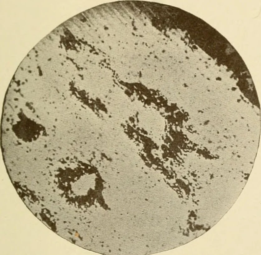 An illustration from The principles and practice of modern surgery / by Roswell Park ... with 722 engravings and 60 full-page plates in colors and monochrome., 1907, leaf 55