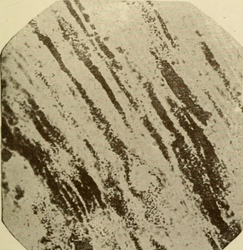 An illustration from The principles and practice of modern surgery / by Roswell Park ... with 722 engravings and 60 full-page plates in colors and monochrome., 1907, leaf 55
