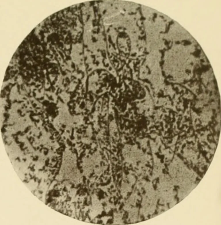 An illustration from The principles and practice of modern surgery / by Roswell Park ... with 722 engravings and 60 full-page plates in colors and monochrome., 1907, leaf 55