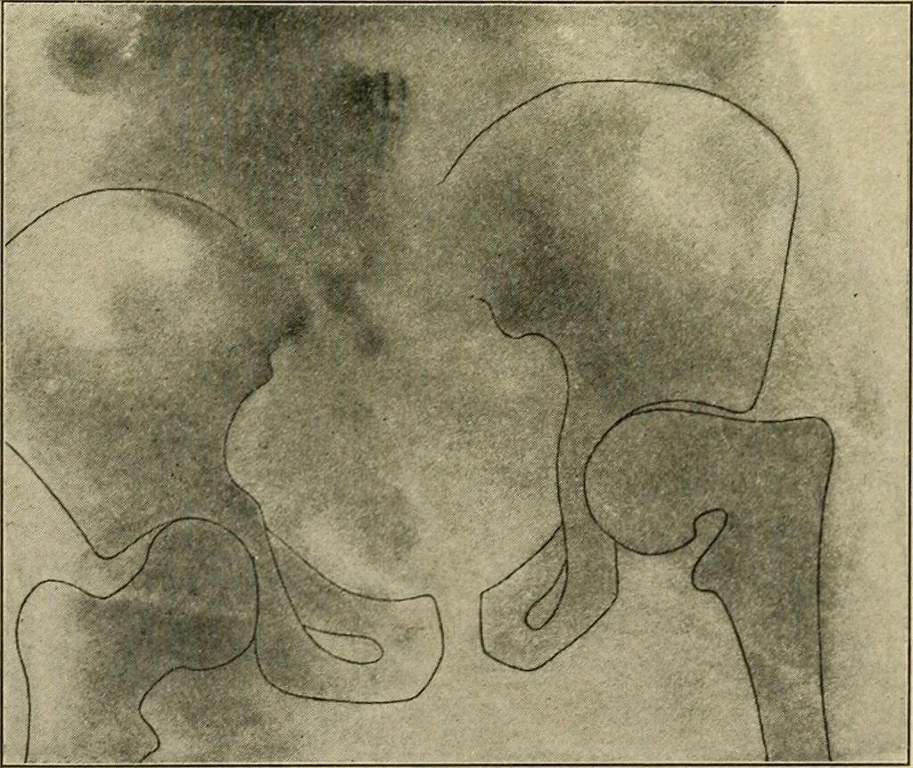 An illustration from The principles and practice of modern surgery / by Roswell Park ... with 722 engravings and 60 full-page plates in colors and monochrome., 1907, leaf 550