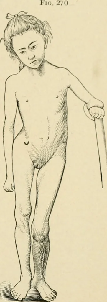 An illustration from The principles and practice of modern surgery / by Roswell Park ... with 722 engravings and 60 full-page plates in colors and monochrome., 1907, leaf 551