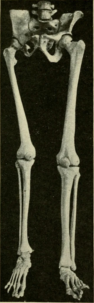An illustration from The principles and practice of modern surgery / by Roswell Park ... with 722 engravings and 60 full-page plates in colors and monochrome., 1907, leaf 554