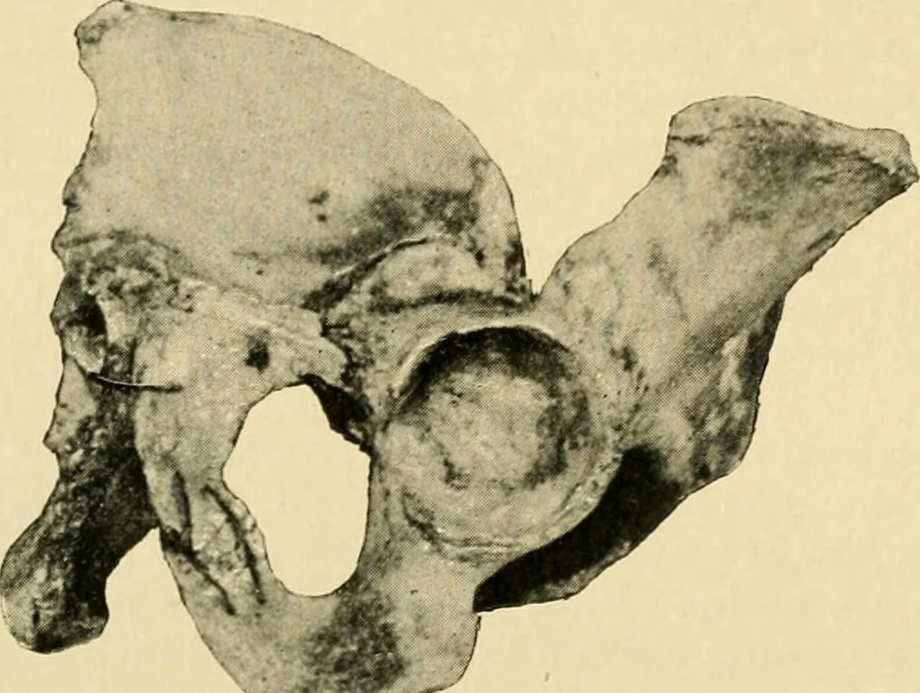 An illustration from The principles and practice of modern surgery / by Roswell Park ... with 722 engravings and 60 full-page plates in colors and monochrome., 1907, leaf 592