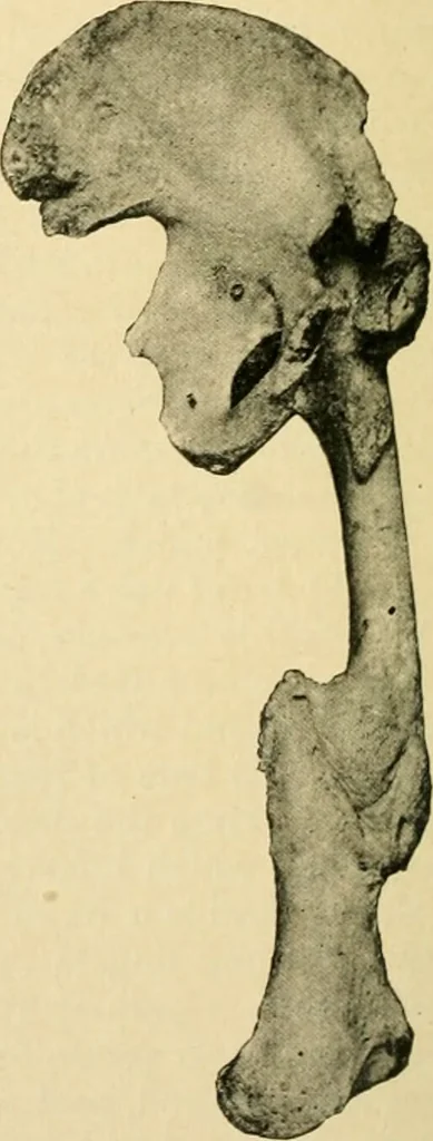 An illustration from The principles and practice of modern surgery / by Roswell Park ... with 722 engravings and 60 full-page plates in colors and monochrome., 1907, leaf 592