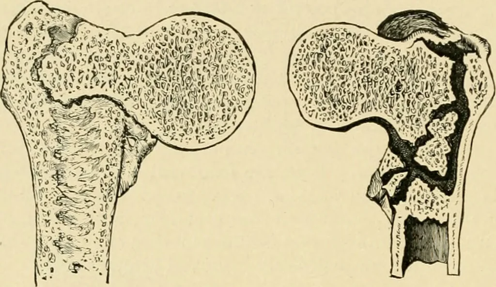 An illustration from The principles and practice of modern surgery / by Roswell Park ... with 722 engravings and 60 full-page plates in colors and monochrome., 1907, leaf 594
