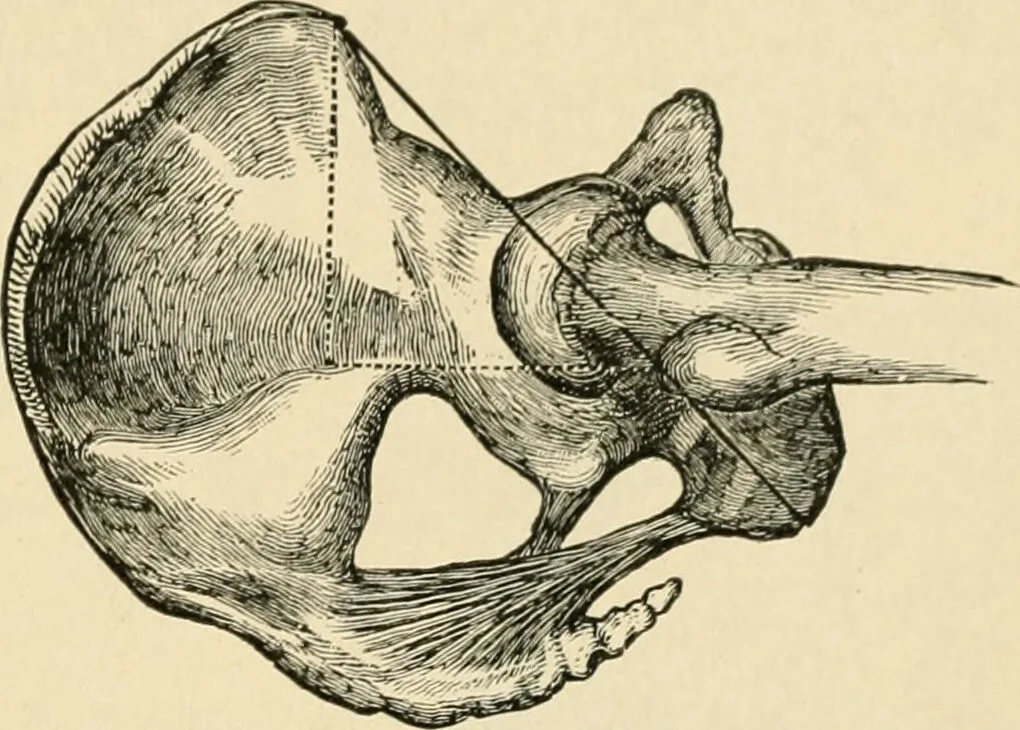 An illustration from The principles and practice of modern surgery / by Roswell Park ... with 722 engravings and 60 full-page plates in colors and monochrome., 1907, leaf 595