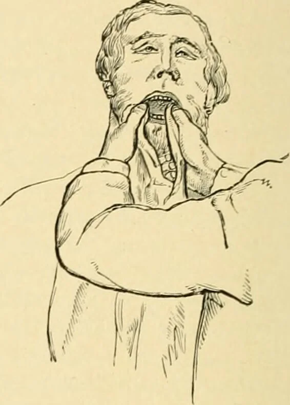 An illustration from The principles and practice of modern surgery / by Roswell Park ... with 722 engravings and 60 full-page plates in colors and monochrome., 1907, leaf 612