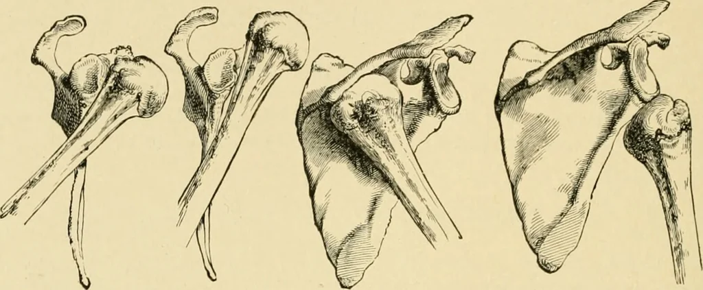 An illustration from The principles and practice of modern surgery / by Roswell Park ... with 722 engravings and 60 full-page plates in colors and monochrome., 1907, leaf 614