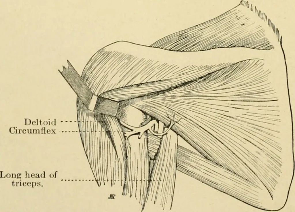 An illustration from The principles and practice of modern surgery / by Roswell Park ... with 722 engravings and 60 full-page plates in colors and monochrome., 1907, leaf 614