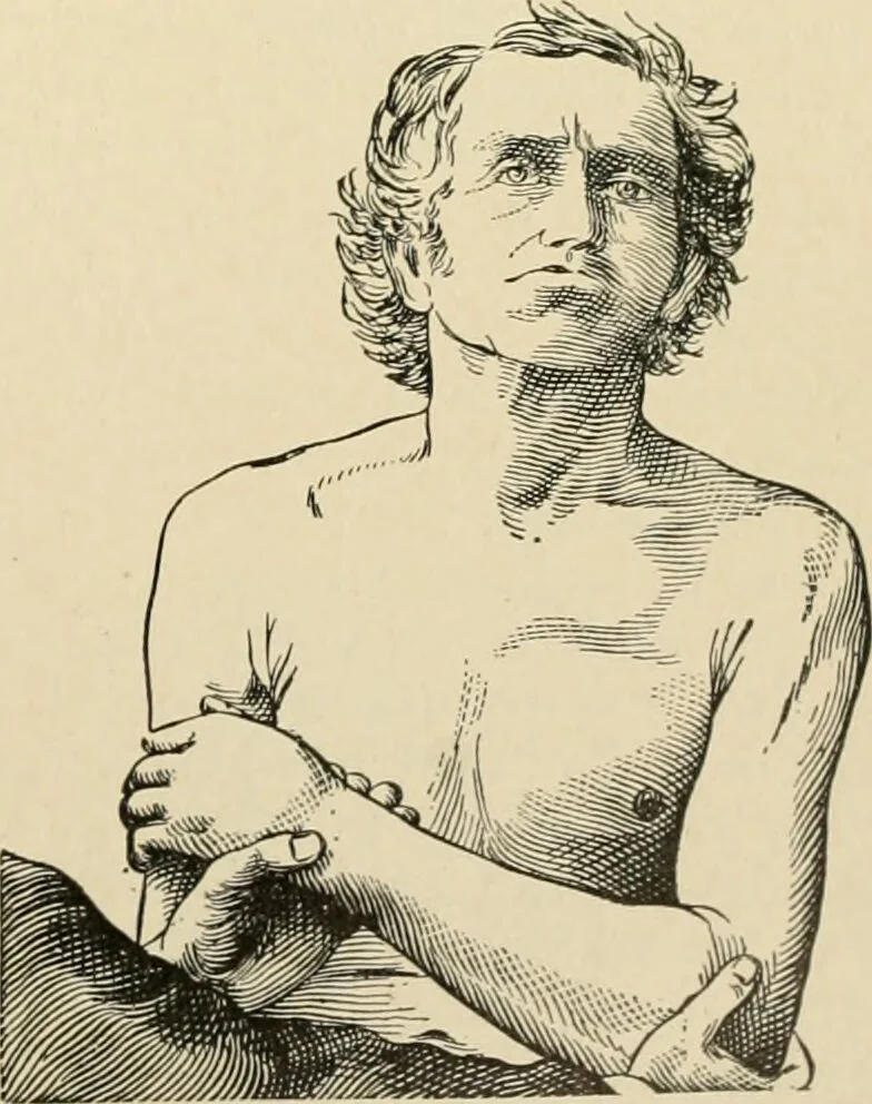 An illustration from The principles and practice of modern surgery / by Roswell Park ... with 722 engravings and 60 full-page plates in colors and monochrome., 1907, leaf 617