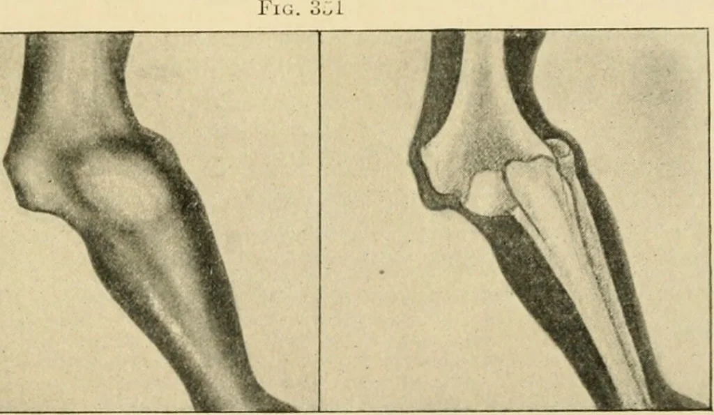 An illustration from The principles and practice of modern surgery / by Roswell Park ... with 722 engravings and 60 full-page plates in colors and monochrome., 1907, leaf 619