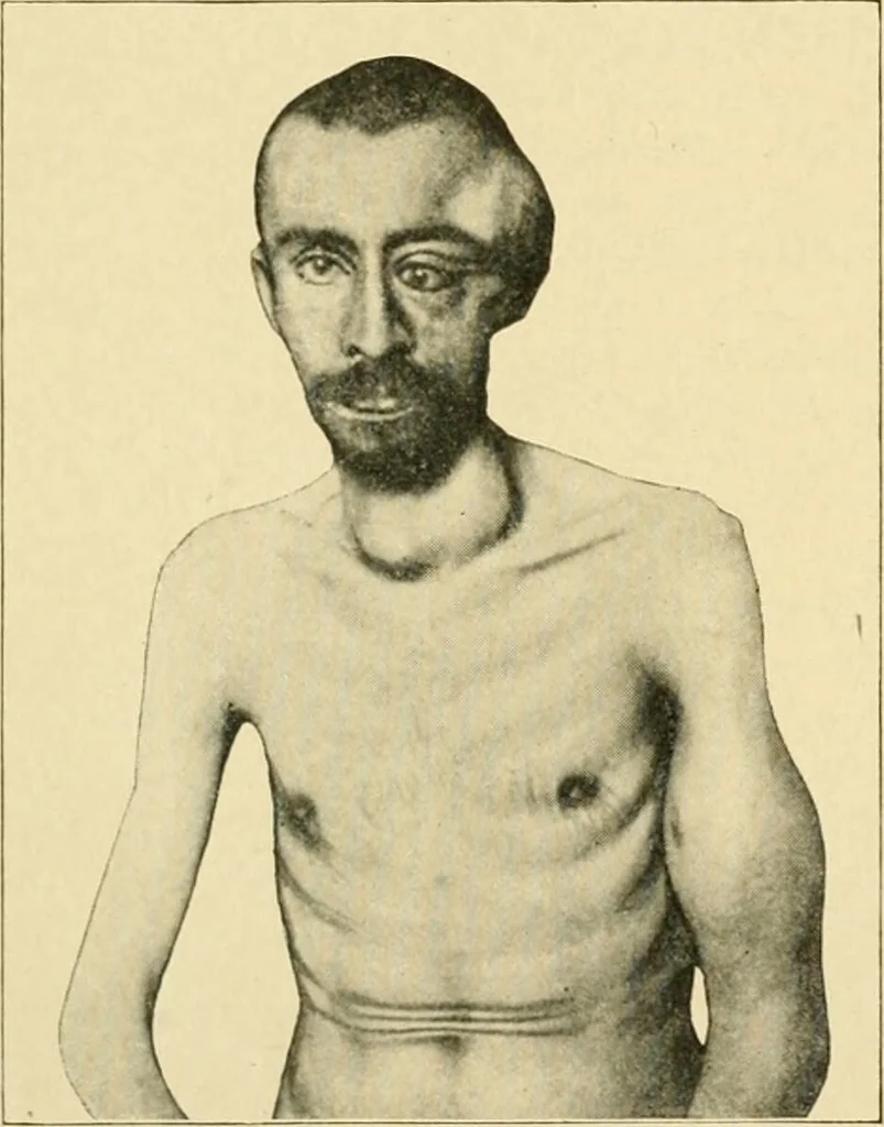 An illustration from The principles and practice of modern surgery / by Roswell Park ... with 722 engravings and 60 full-page plates in colors and monochrome., 1907, leaf 630