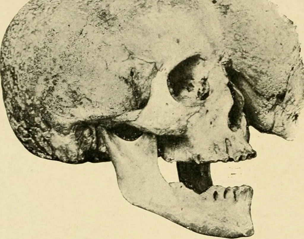 An illustration from The principles and practice of modern surgery / by Roswell Park ... with 722 engravings and 60 full-page plates in colors and monochrome., 1907, leaf 632