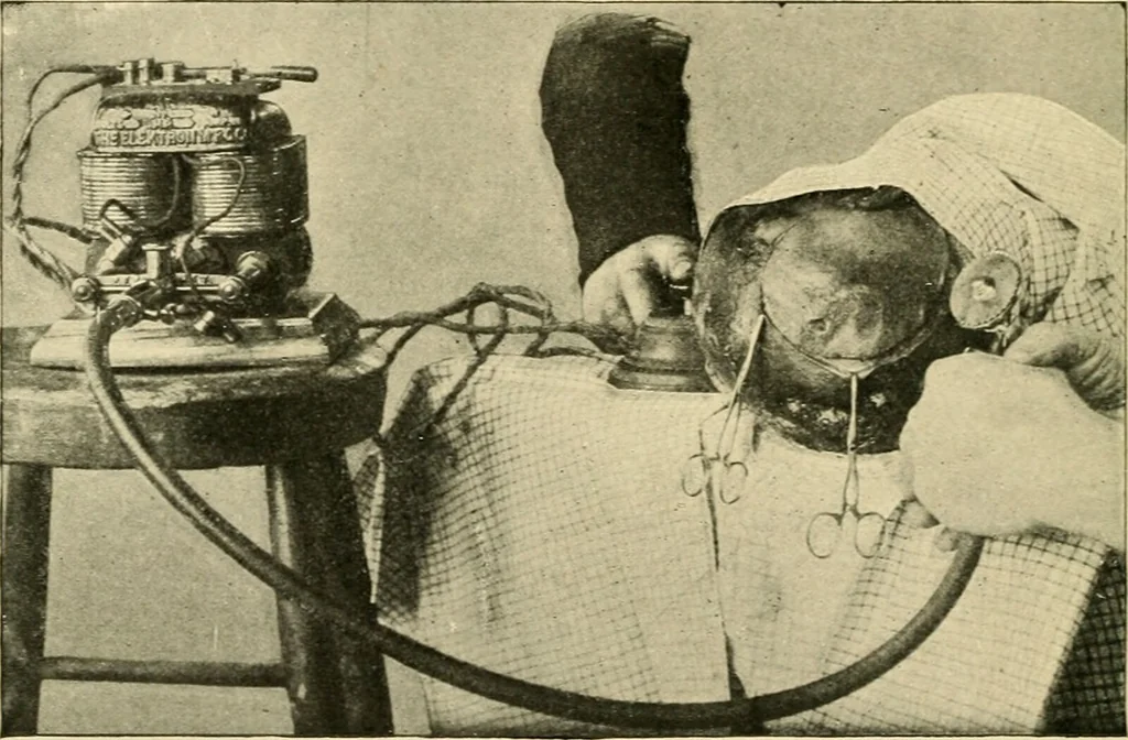 An illustration from The principles and practice of modern surgery / by Roswell Park ... with 722 engravings and 60 full-page plates in colors and monochrome., 1907, leaf 678