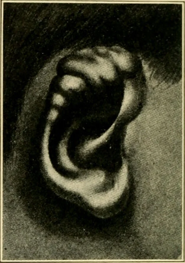 An illustration from The principles and practice of modern surgery / by Roswell Park ... with 722 engravings and 60 full-page plates in colors and monochrome., 1907, leaf 698