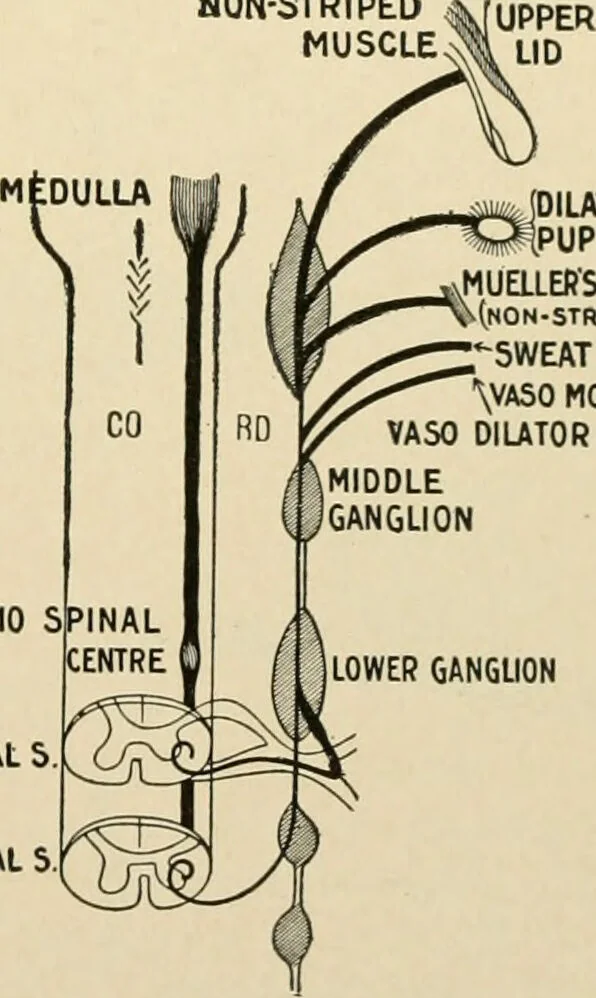 An illustration from The principles and practice of modern surgery / by Roswell Park ... with 722 engravings and 60 full-page plates in colors and monochrome., 1907, leaf 711