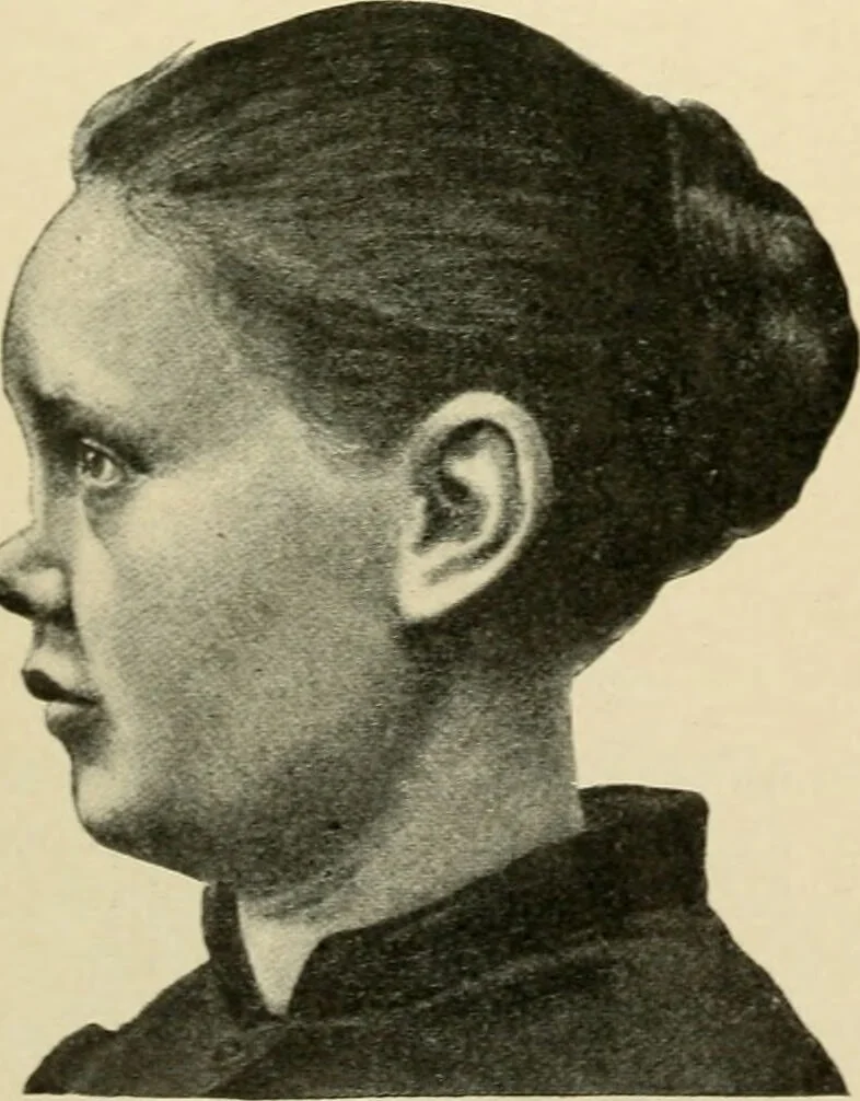An illustration from The principles and practice of modern surgery / by Roswell Park ... with 722 engravings and 60 full-page plates in colors and monochrome., 1907, leaf 740