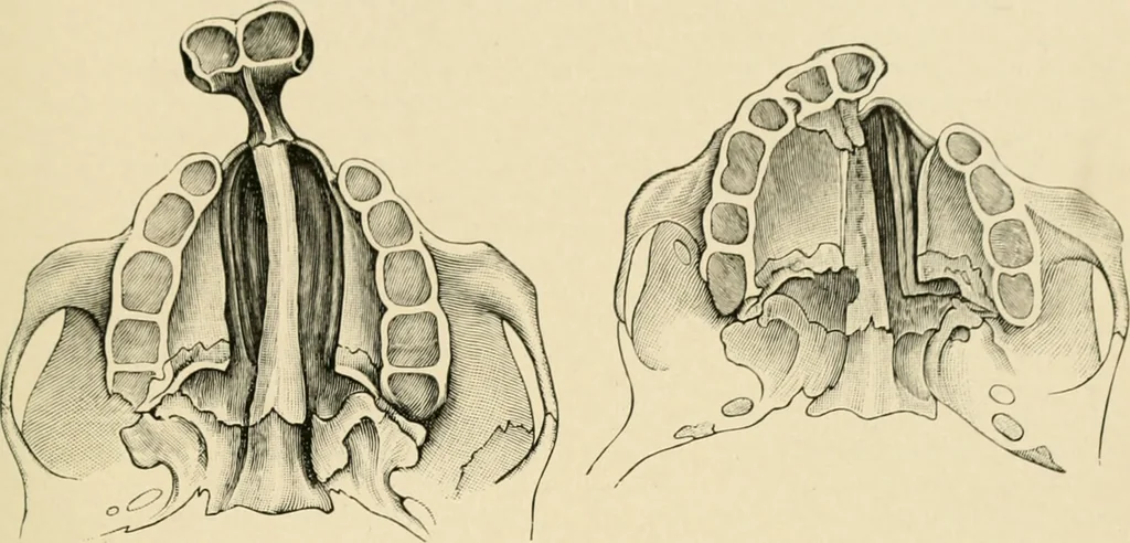 An illustration from The principles and practice of modern surgery / by Roswell Park ... with 722 engravings and 60 full-page plates in colors and monochrome., 1907, leaf 749
