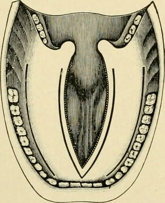 An illustration from The principles and practice of modern surgery / by Roswell Park ... with 722 engravings and 60 full-page plates in colors and monochrome., 1907, leaf 752