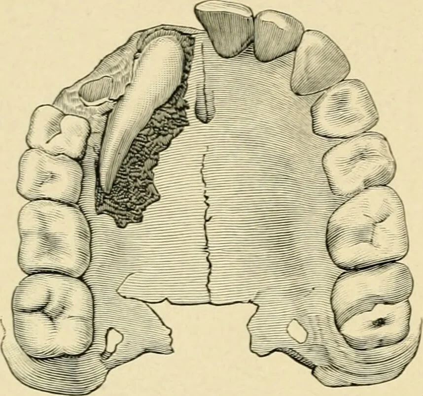 An illustration from The principles and practice of modern surgery / by Roswell Park ... with 722 engravings and 60 full-page plates in colors and monochrome., 1907, leaf 754