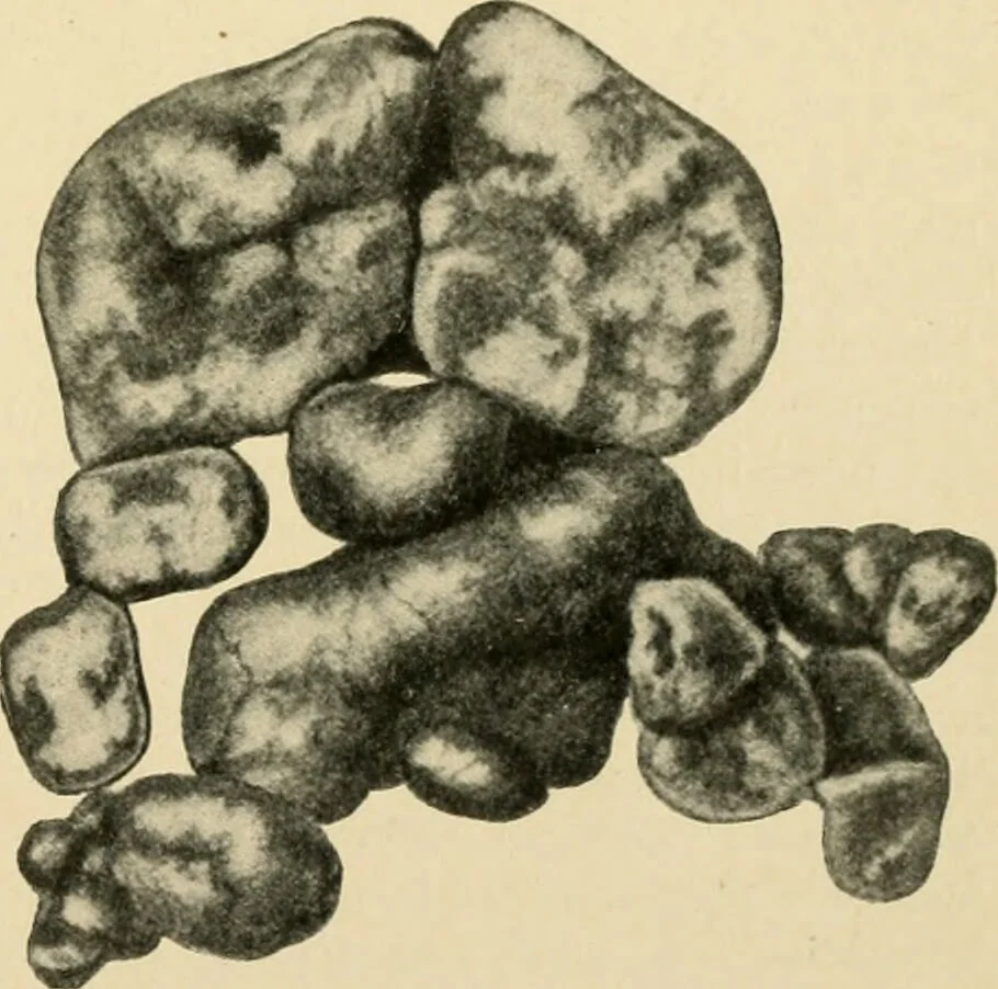An illustration from The principles and practice of modern surgery / by Roswell Park ... with 722 engravings and 60 full-page plates in colors and monochrome., 1907, leaf 801