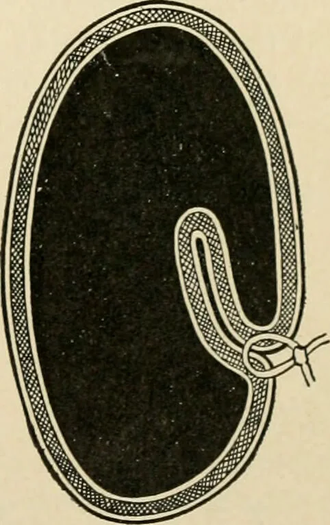 An illustration from The principles and practice of modern surgery / by Roswell Park ... with 722 engravings and 60 full-page plates in colors and monochrome., 1907, leaf 911