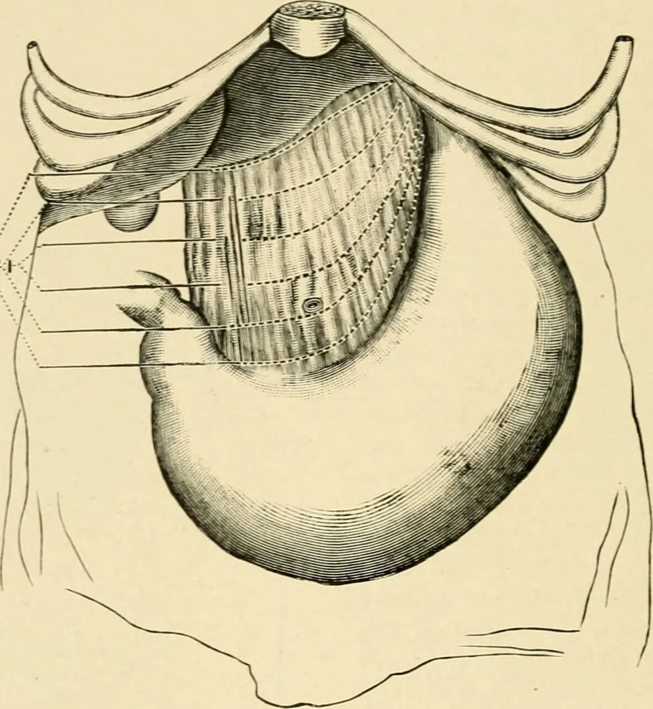 An illustration from The principles and practice of modern surgery / by Roswell Park ... with 722 engravings and 60 full-page plates in colors and monochrome., 1907, leaf 914