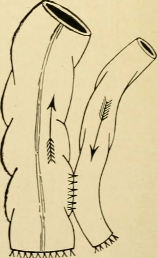 An illustration from The principles and practice of modern surgery / by Roswell Park ... with 722 engravings and 60 full-page plates in colors and monochrome., 1907, leaf 950