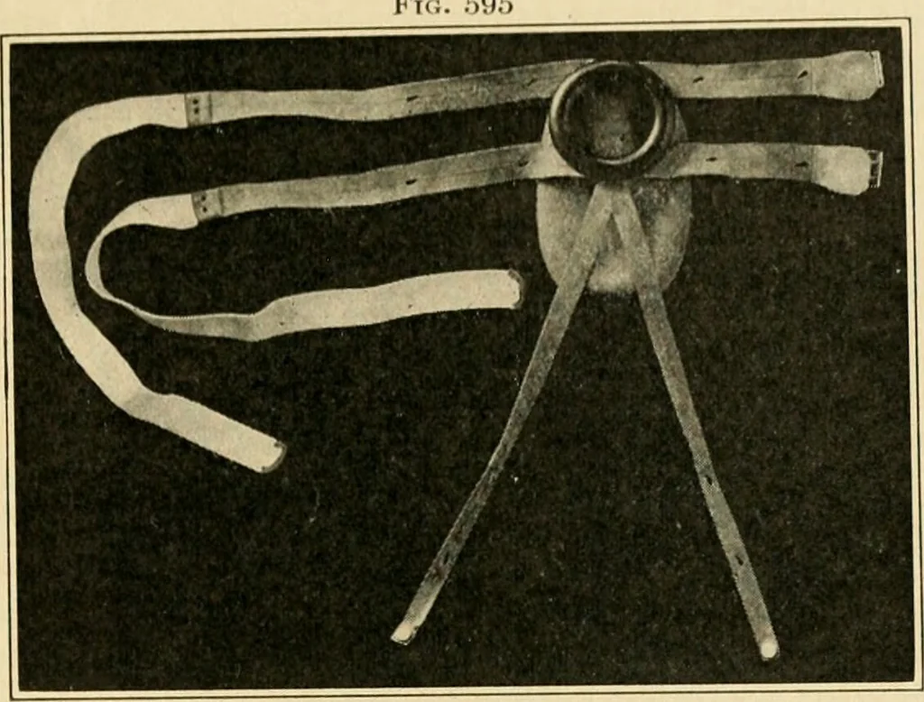 An illustration from The principles and practice of modern surgery / by Roswell Park ... with 722 engravings and 60 full-page plates in colors and monochrome., 1907, leaf 997