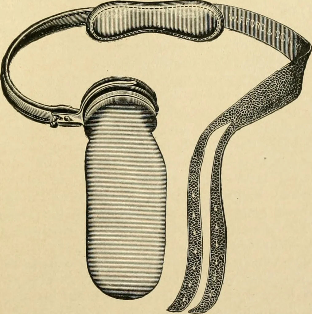 An illustration from The principles and practice of modern surgery / by Roswell Park ... with 722 engravings and 60 full-page plates in colors and monochrome., 1907, leaf 997