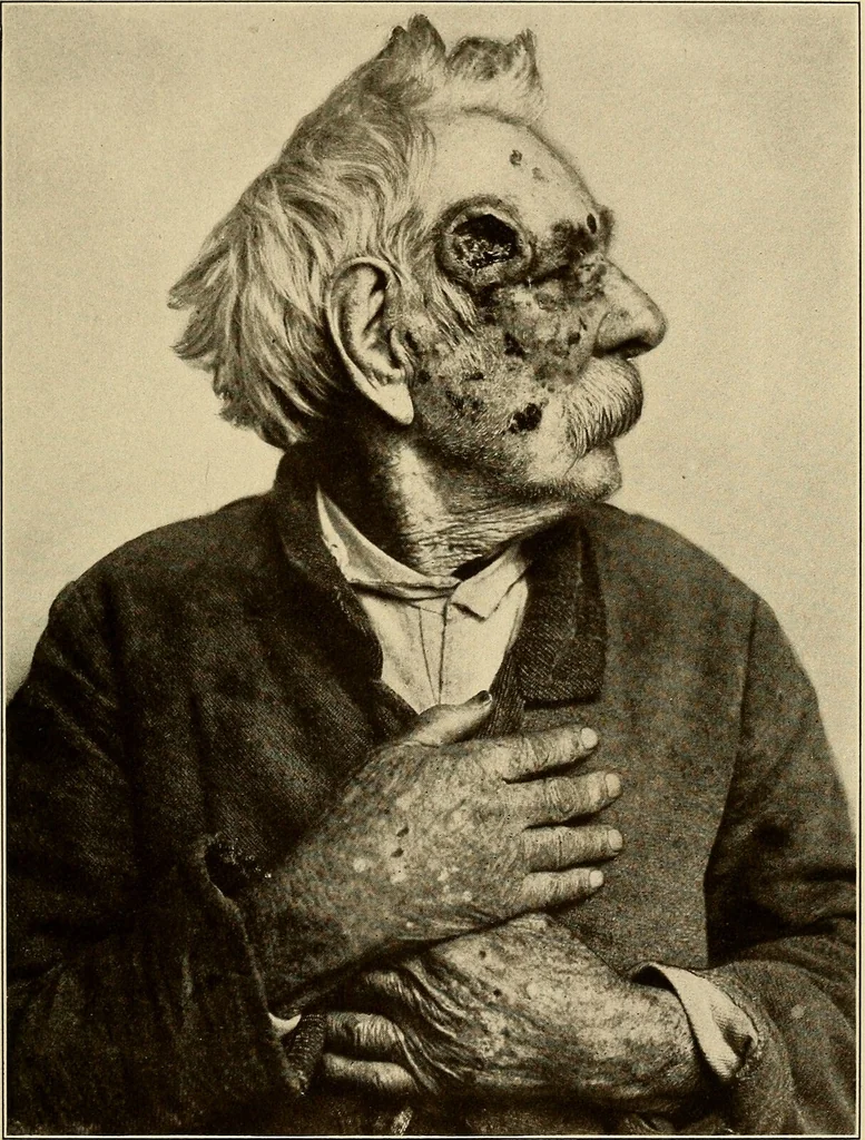 An illustration from Surgical diagnosis / by Edward Martin ... illustrated with 445 engravings and 18 plates in colors and monochrome., 1909, leaf 105