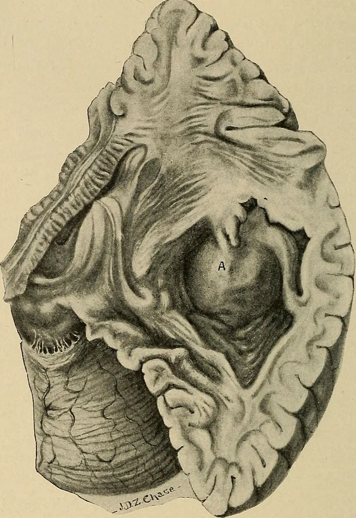 An illustration from Surgical diagnosis / by Edward Martin ... illustrated with 445 engravings and 18 plates in colors and monochrome., 1909, leaf 186