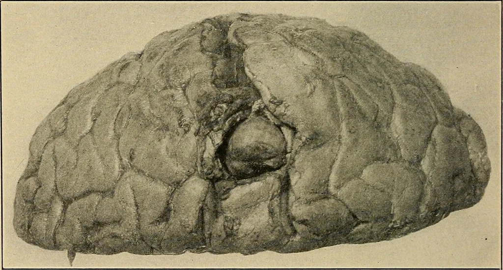 An illustration from Surgical diagnosis / by Edward Martin ... illustrated with 445 engravings and 18 plates in colors and monochrome., 1909, leaf 188