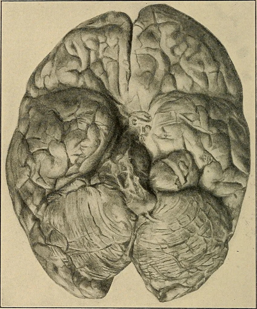 An illustration from Surgical diagnosis / by Edward Martin ... illustrated with 445 engravings and 18 plates in colors and monochrome., 1909, leaf 198