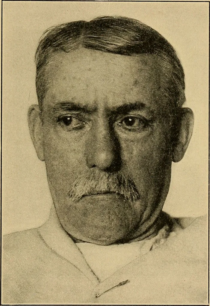 An illustration from Surgical diagnosis / by Edward Martin ... illustrated with 445 engravings and 18 plates in colors and monochrome., 1909, leaf 235