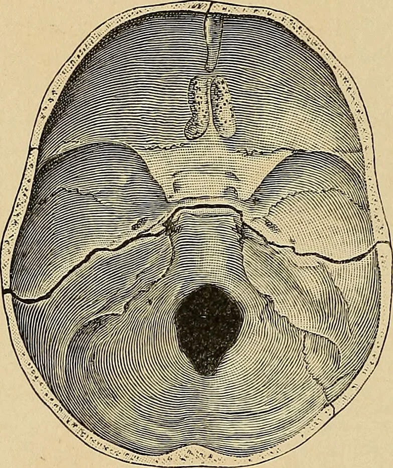 An illustration from Surgical diagnosis / by Edward Martin ... illustrated with 445 engravings and 18 plates in colors and monochrome., 1909, leaf 250