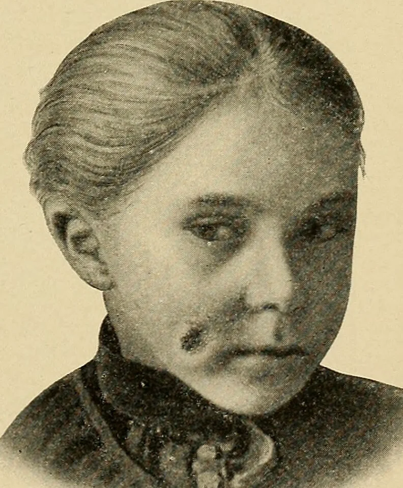 An illustration from Surgical diagnosis / by Edward Martin ... illustrated with 445 engravings and 18 plates in colors and monochrome., 1909, leaf 275