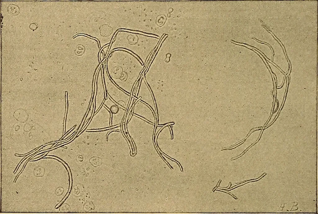 An illustration from Surgical diagnosis / by Edward Martin ... illustrated with 445 engravings and 18 plates in colors and monochrome., 1909, leaf 36