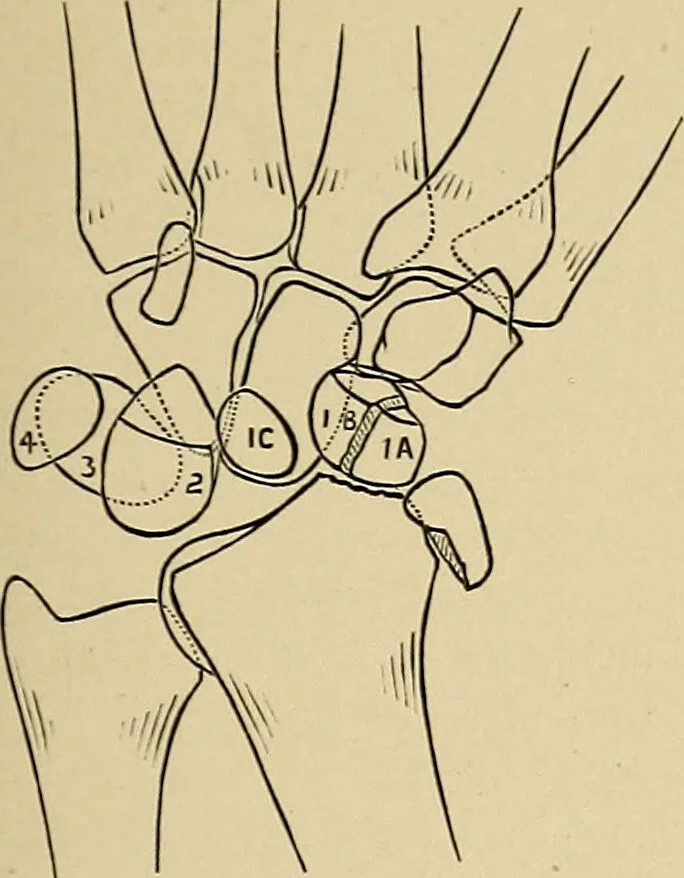 An illustration from Surgical diagnosis / by Edward Martin ... illustrated with 445 engravings and 18 plates in colors and monochrome., 1909, leaf 387