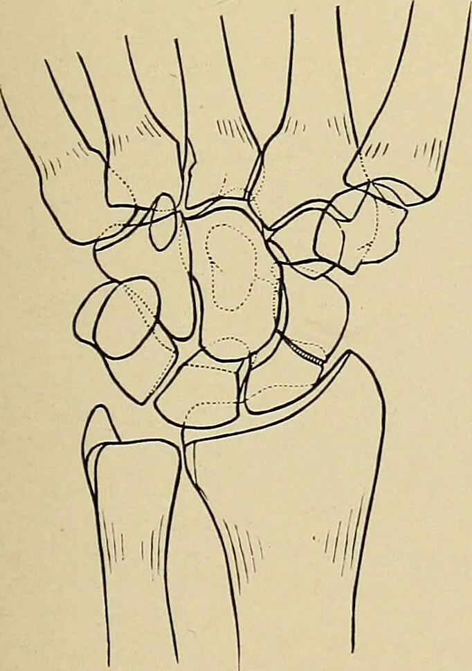 An illustration from Surgical diagnosis / by Edward Martin ... illustrated with 445 engravings and 18 plates in colors and monochrome., 1909, leaf 389