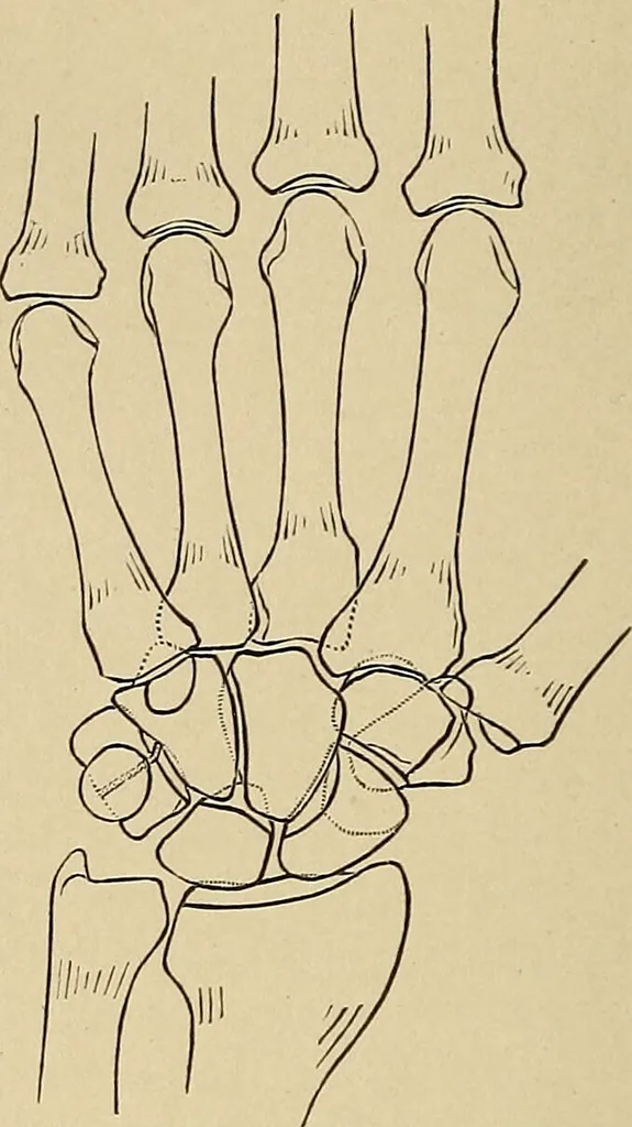 An illustration from Surgical diagnosis / by Edward Martin ... illustrated with 445 engravings and 18 plates in colors and monochrome., 1909, leaf 390
