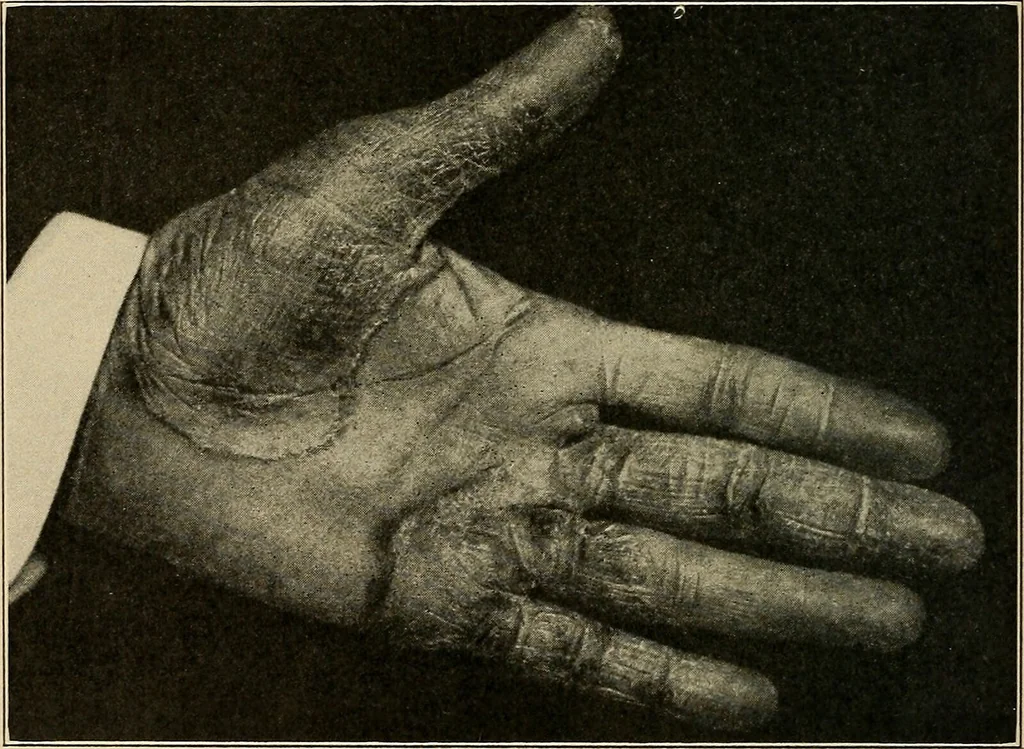 An illustration from Surgical diagnosis / by Edward Martin ... illustrated with 445 engravings and 18 plates in colors and monochrome., 1909, leaf 396
