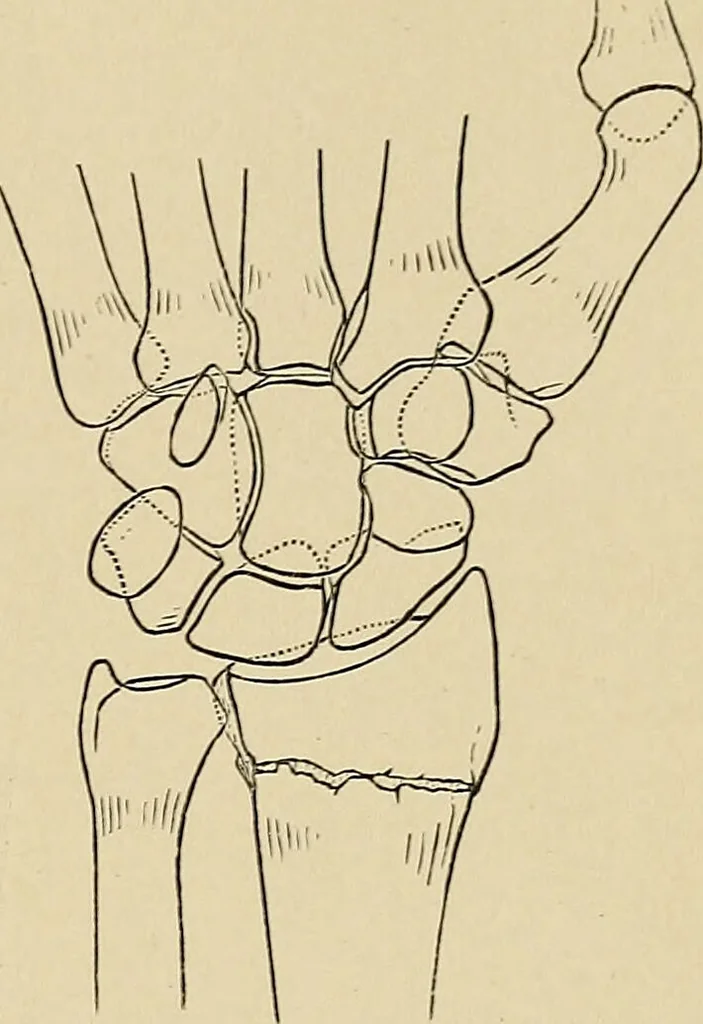 An illustration from Surgical diagnosis / by Edward Martin ... illustrated with 445 engravings and 18 plates in colors and monochrome., 1909, leaf 407