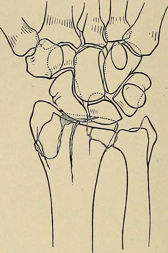 An illustration from Surgical diagnosis / by Edward Martin ... illustrated with 445 engravings and 18 plates in colors and monochrome., 1909, leaf 408